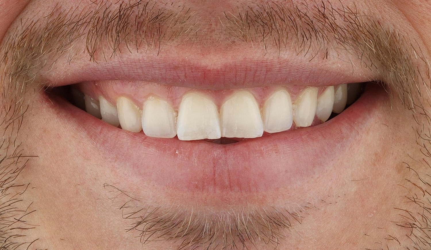 Patients Before & After