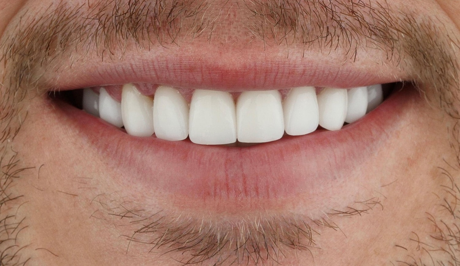 Patients Before & After