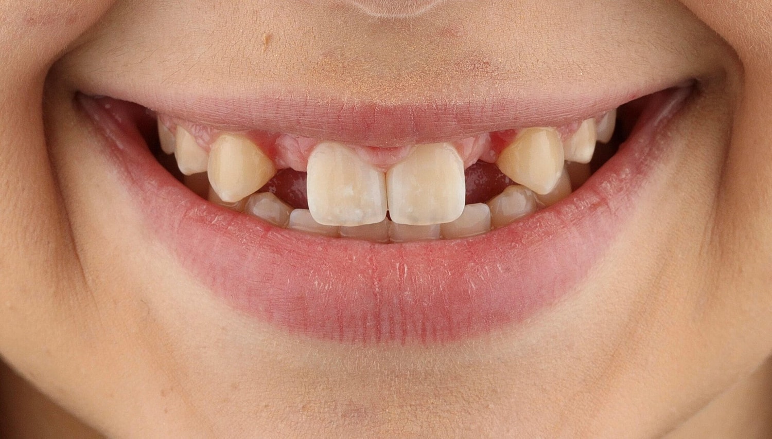 Patients Before & After