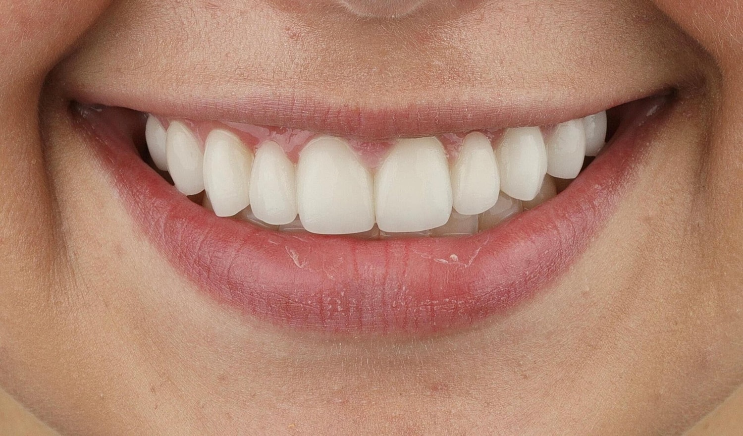 Patients Before & After
