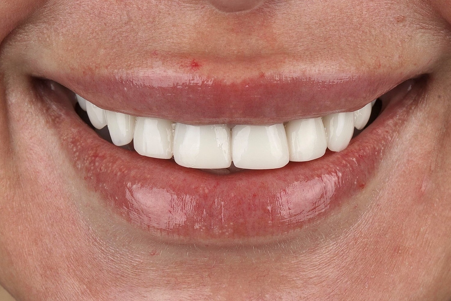 Patients Before & After