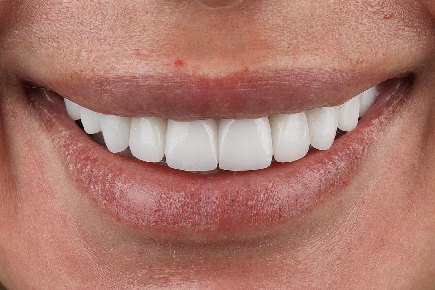 Patients Before & After
