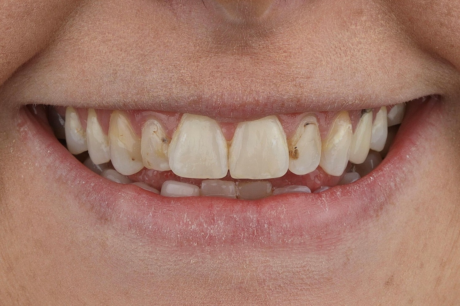 Patients Before & After