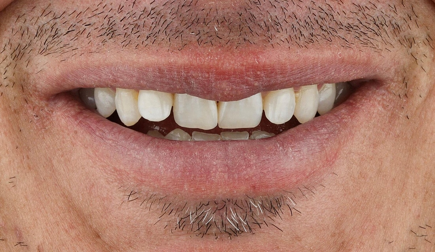 Patients Before & After