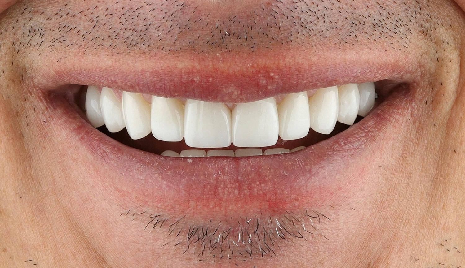 Patients Before & After