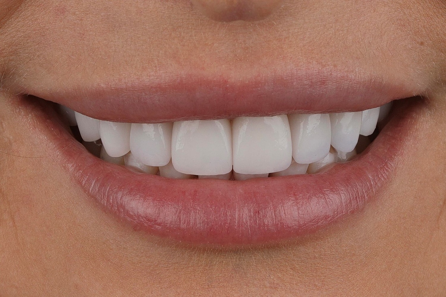 Patients Before & After