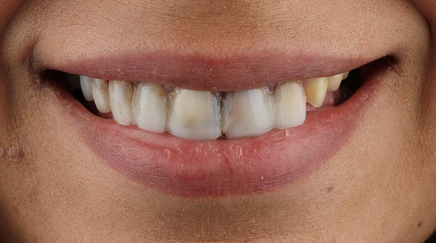 Patients Before & After