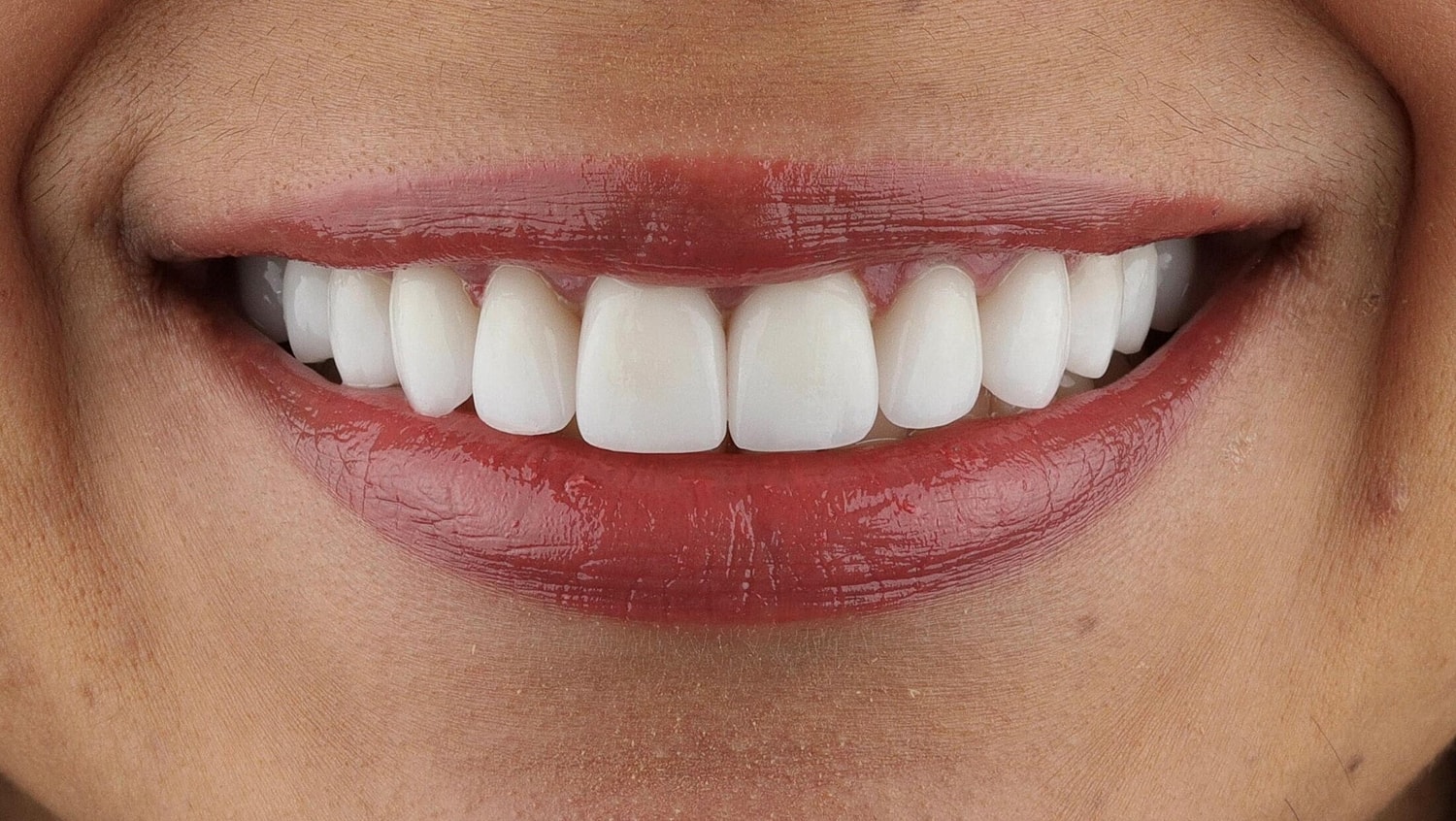 Patients Before & After