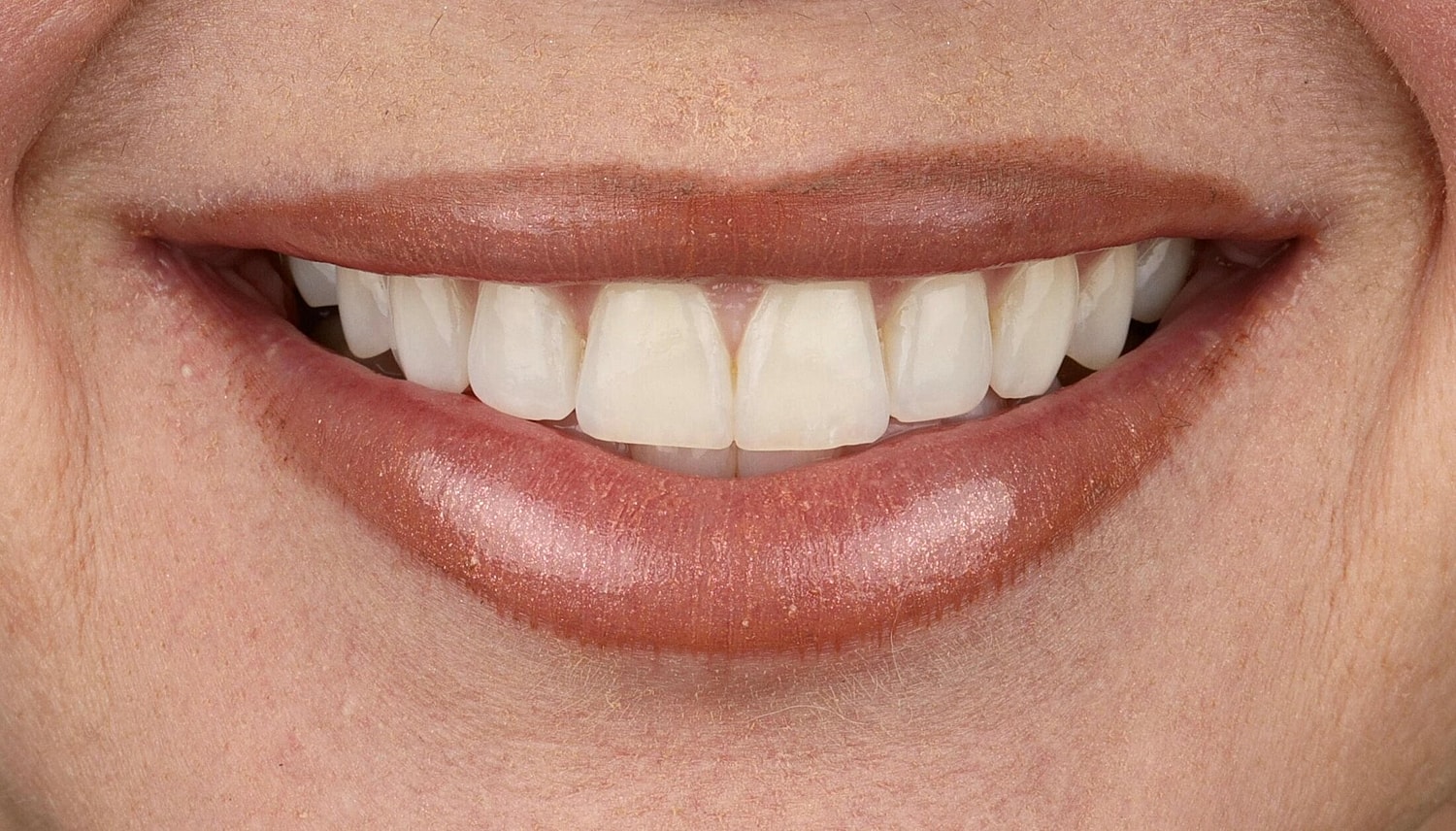 Patients Before & After