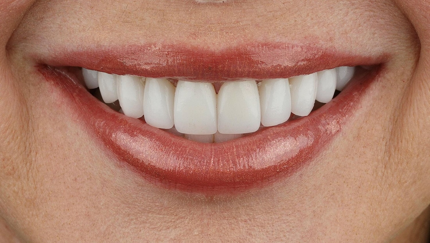 Patients Before & After
