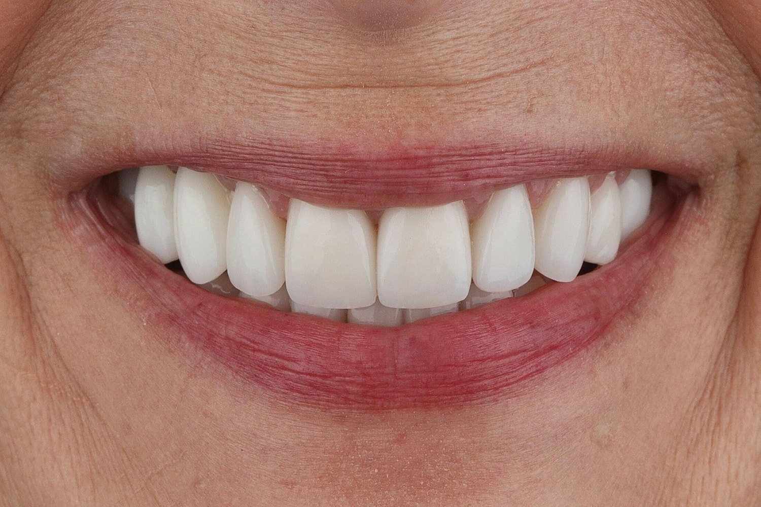 Patients Before & After