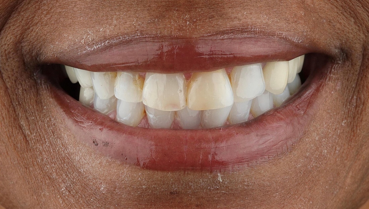 Patients Before & After