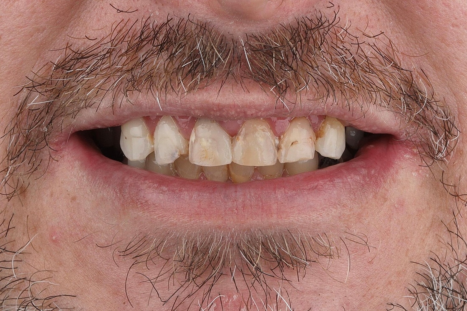 Patients Before & After