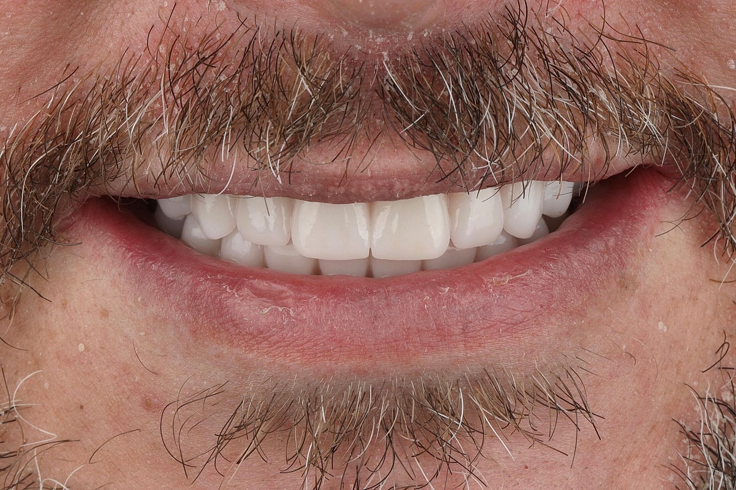Patients Before & After