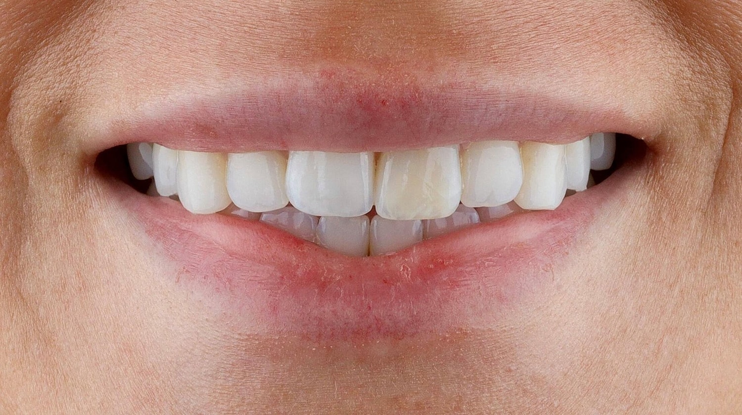 Patients Before & After