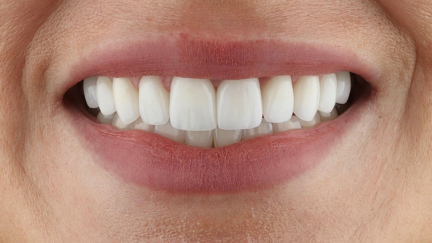 Patients Before & After