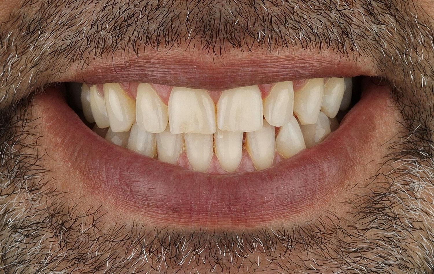 Patients Before & After