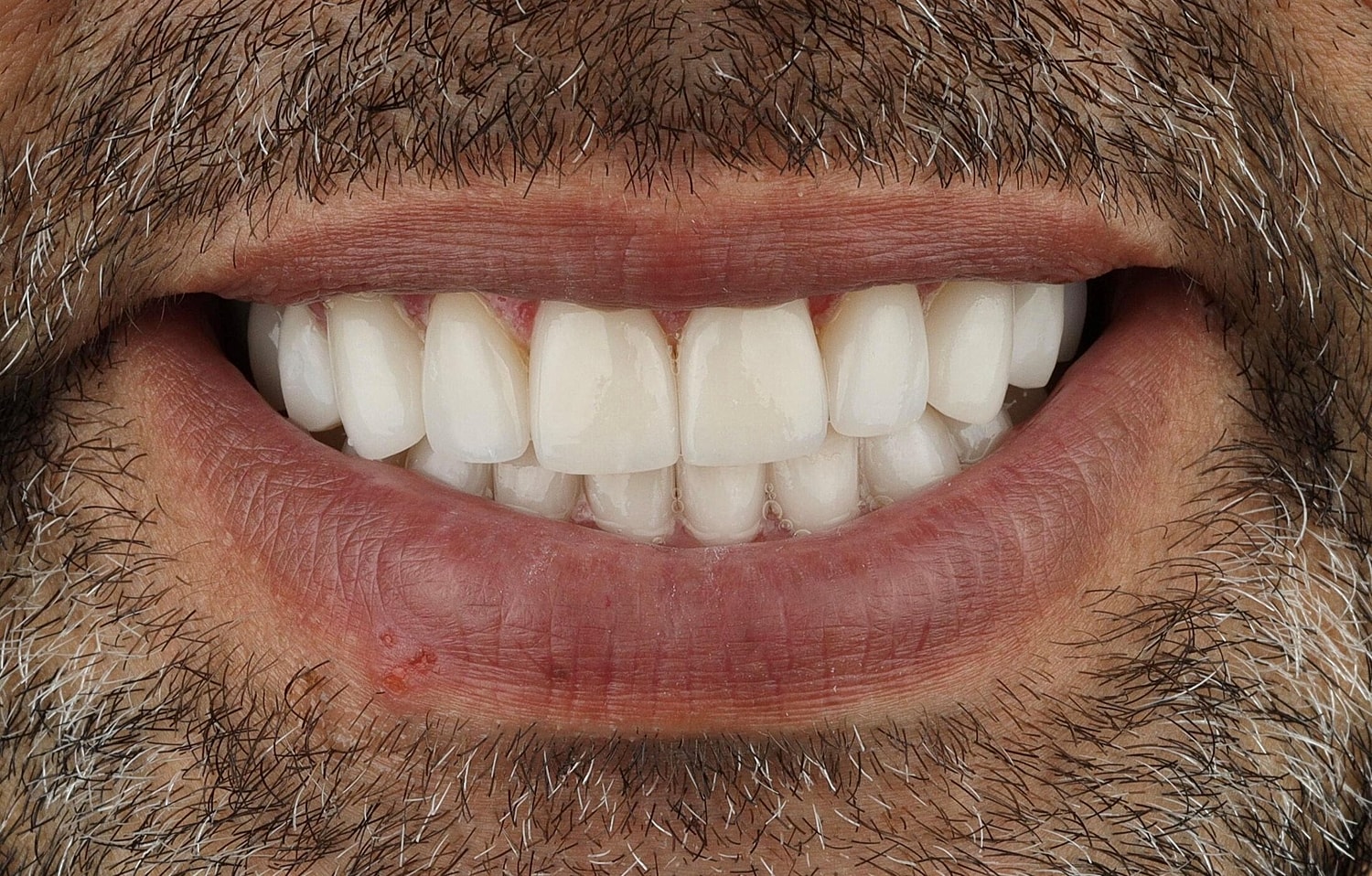 Patients Before & After