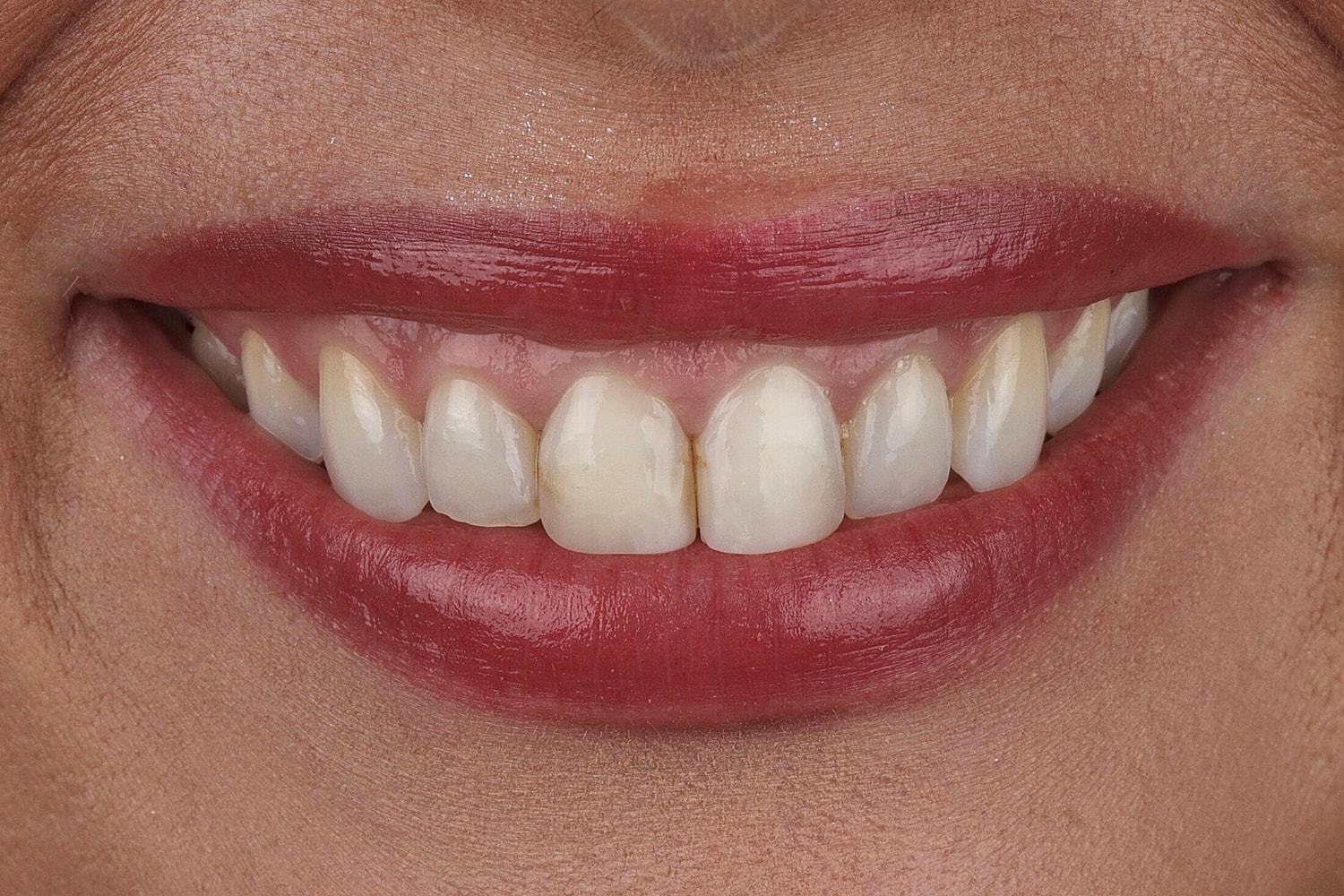 Patients Before & After