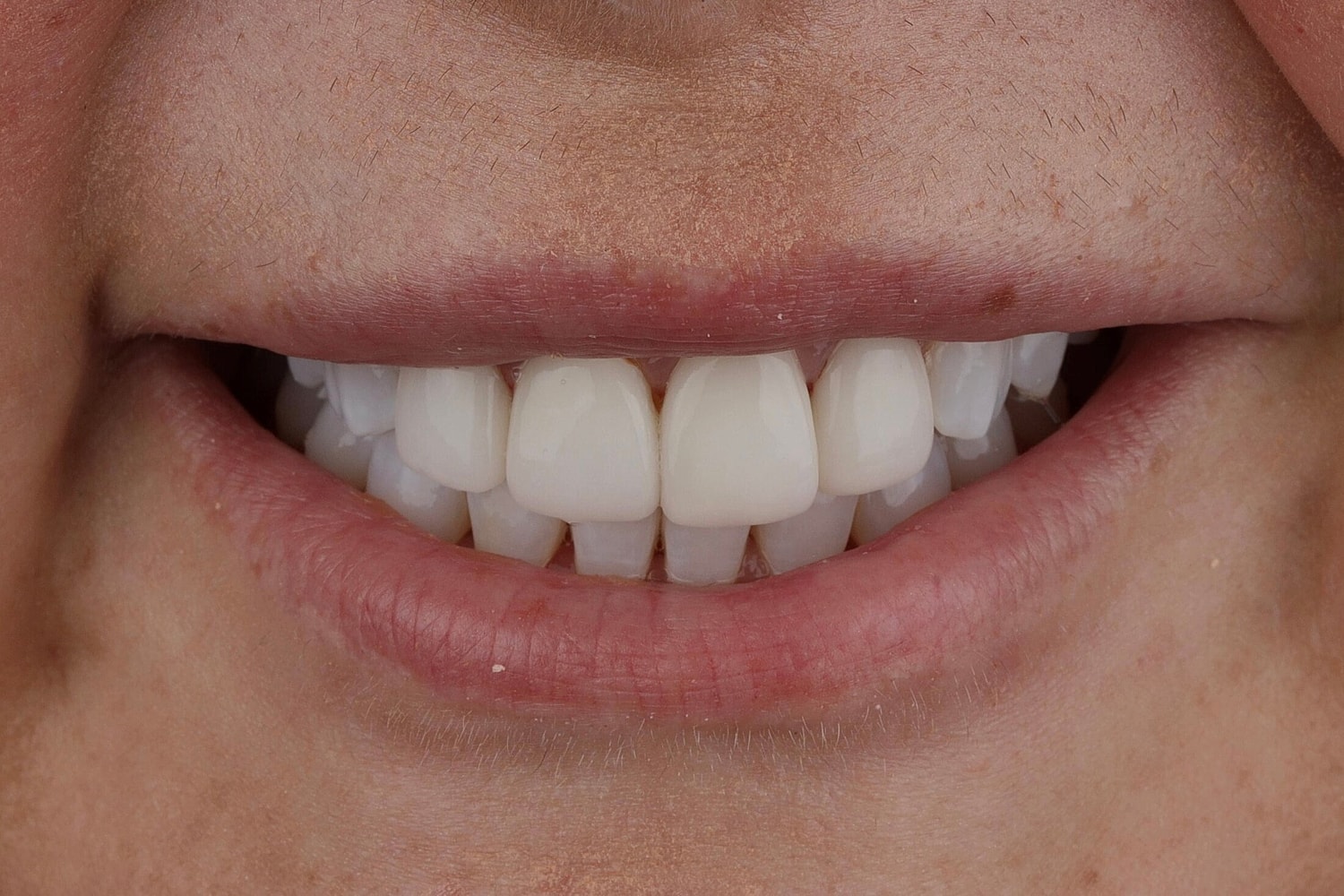 Patients Before & After
