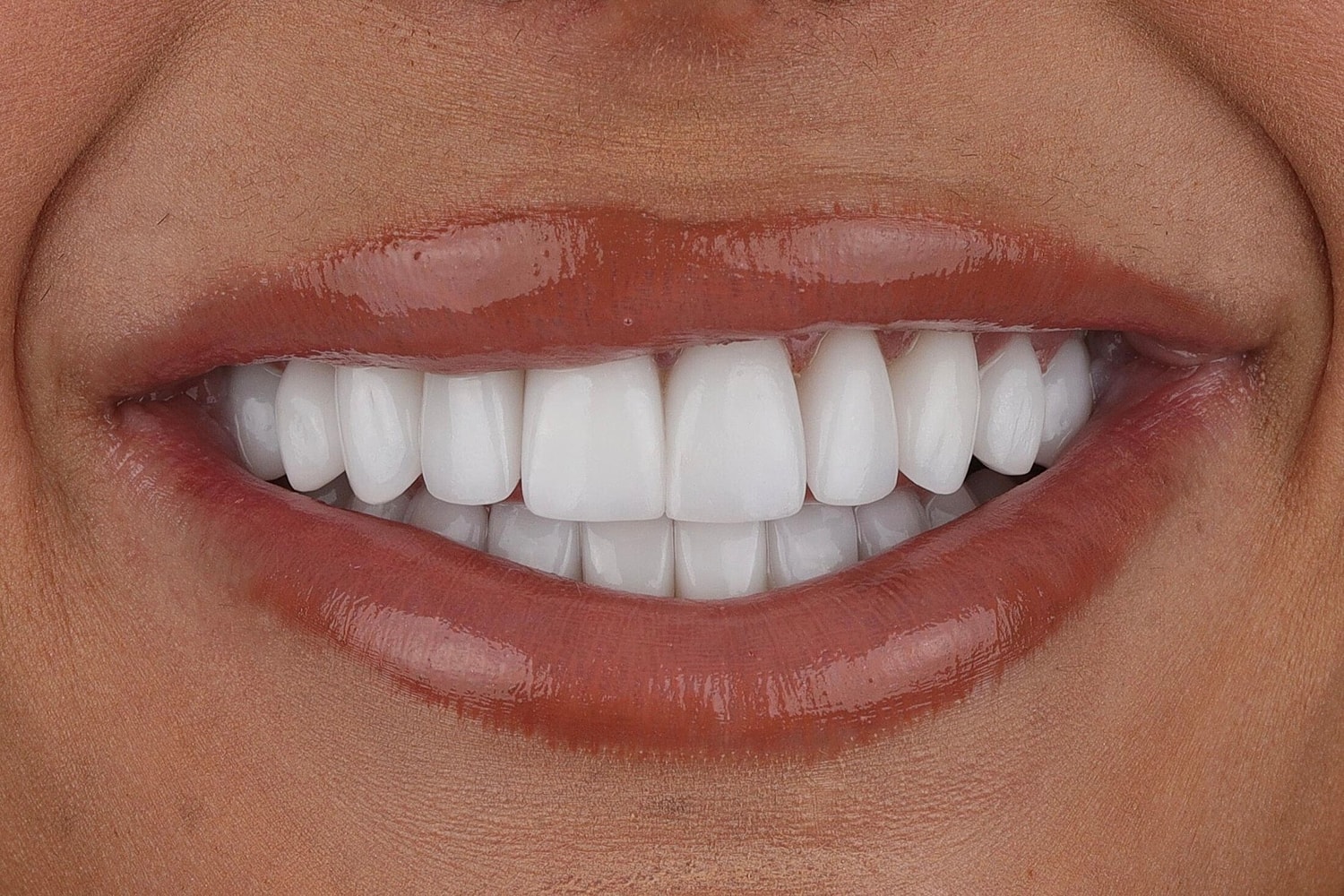 Patients Before & After