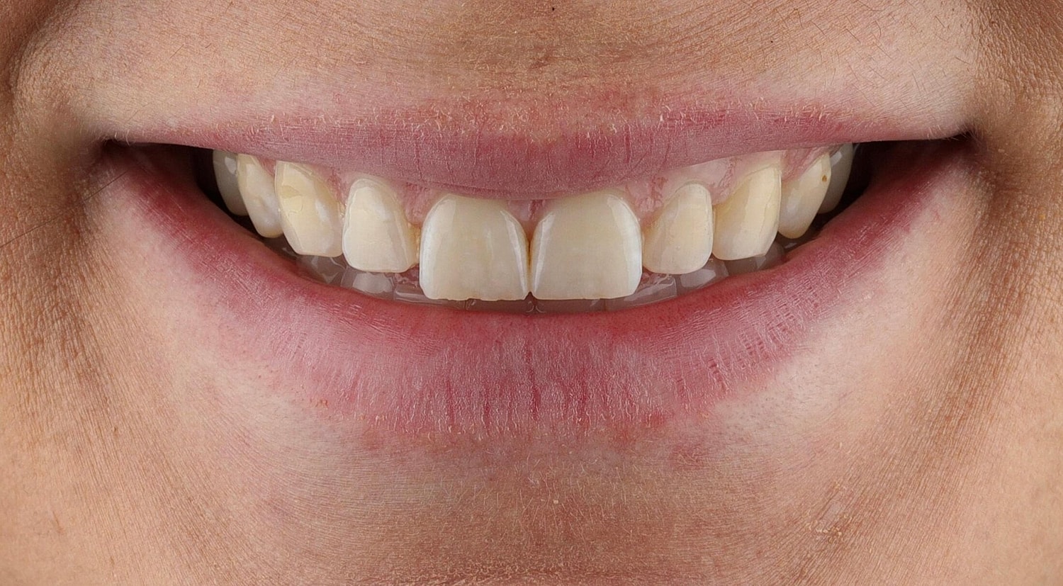 Patients Before & After