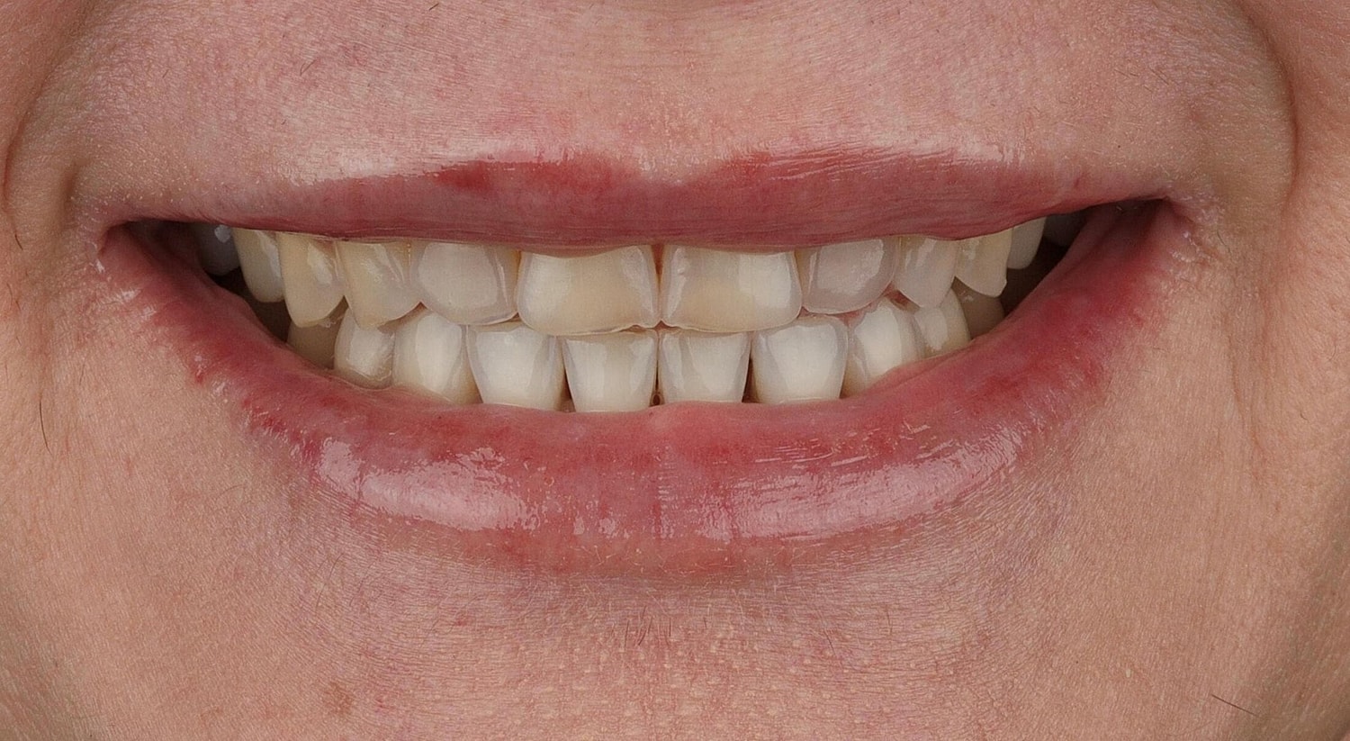 Patients Before & After