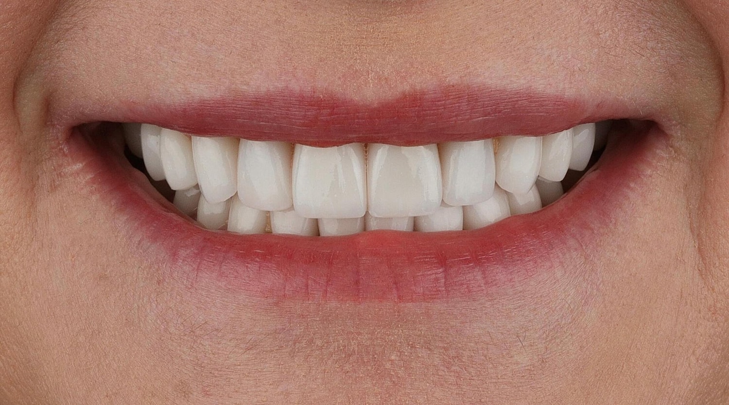 Patients Before & After