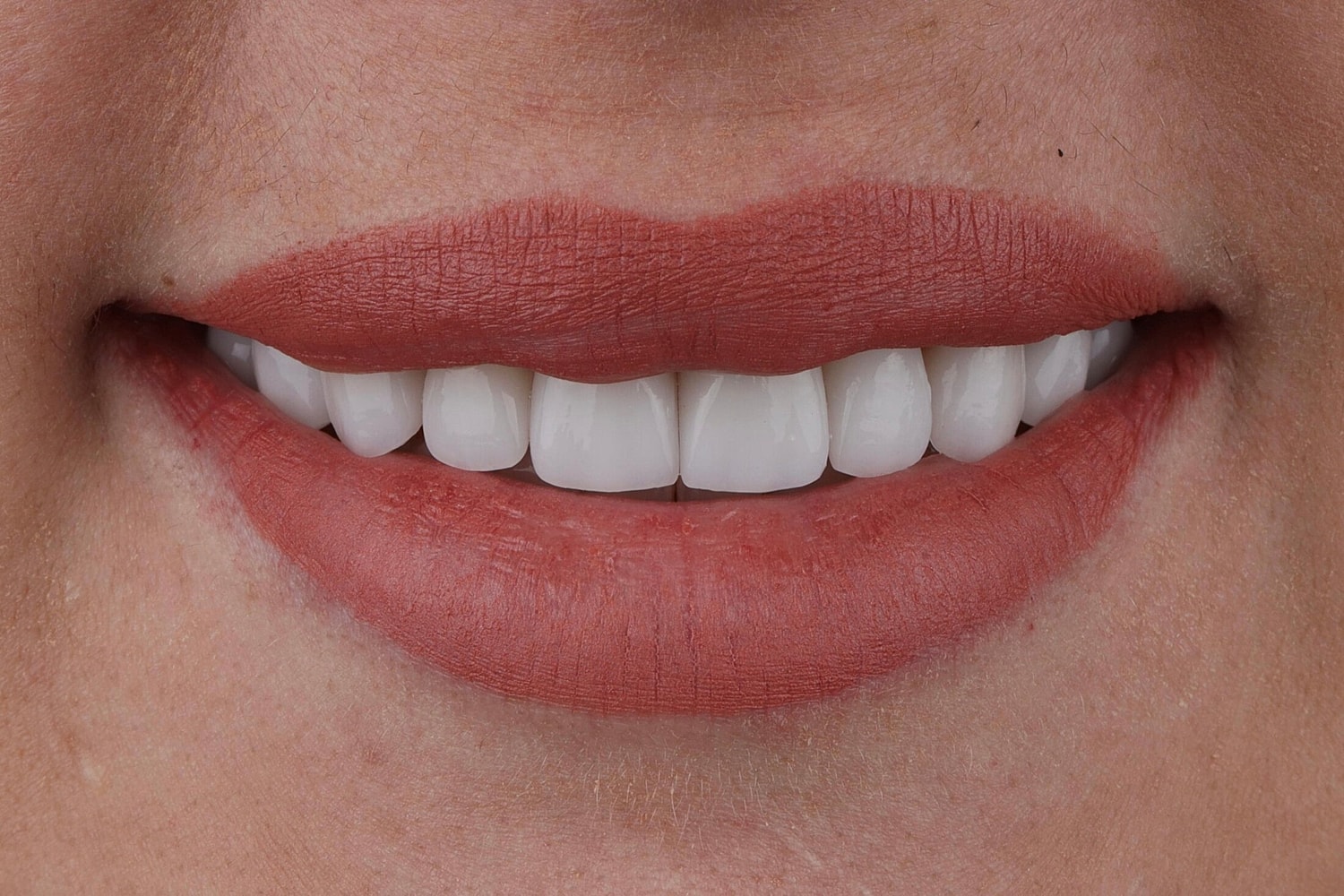Patients Before & After