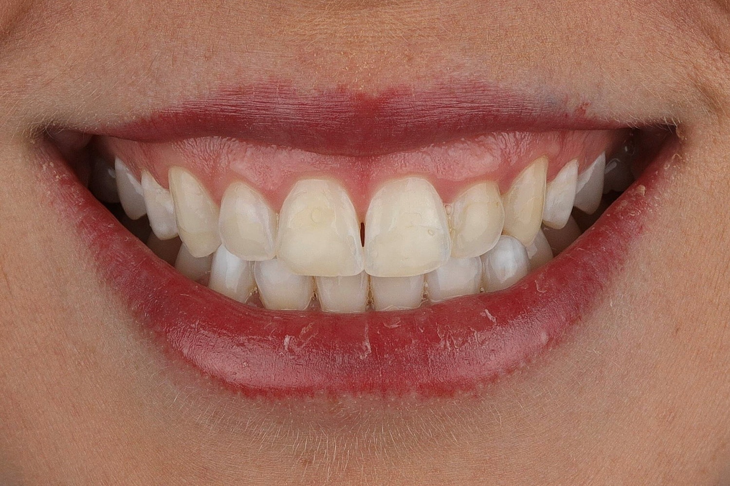 Patients Before & After