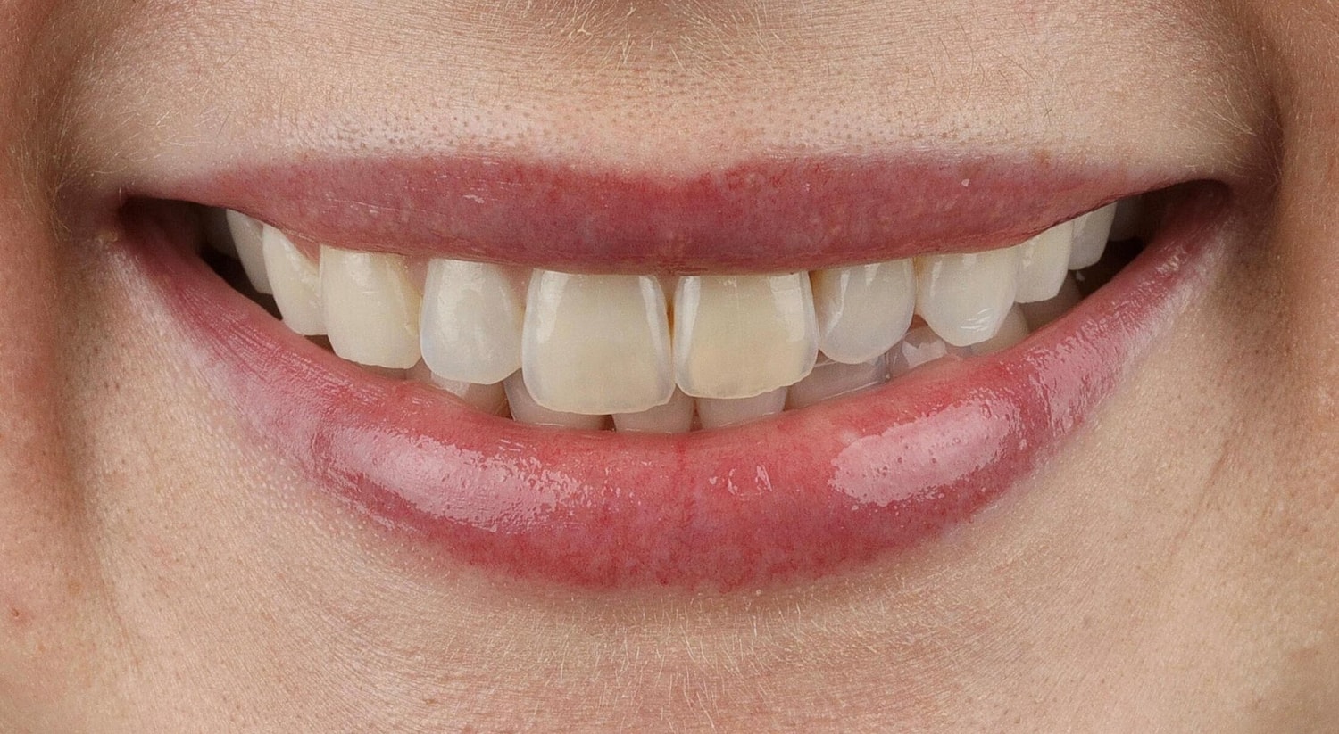 Patients Before & After
