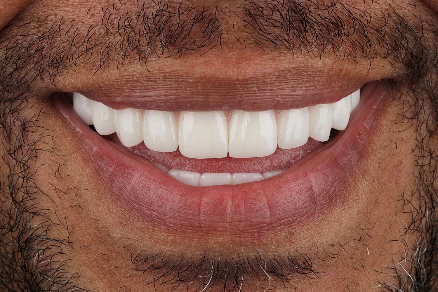 Patients Before & After