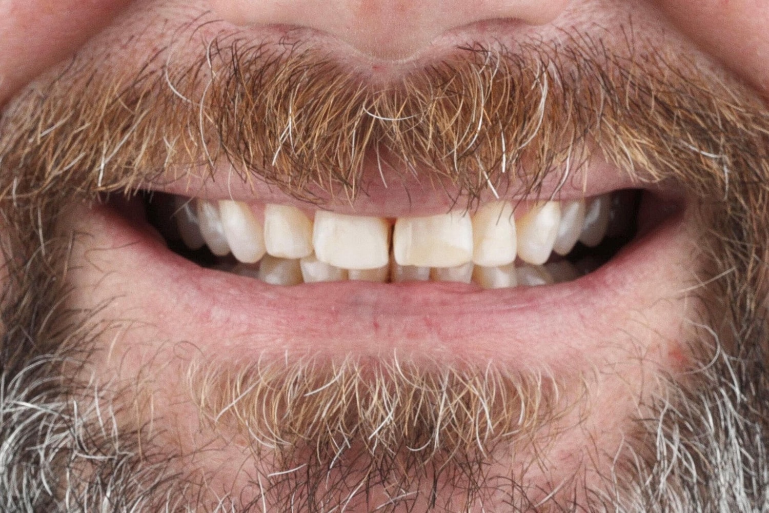 Patients Before & After