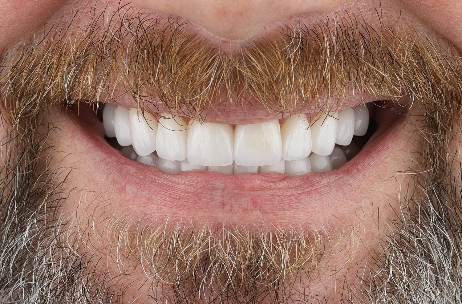Patients Before & After