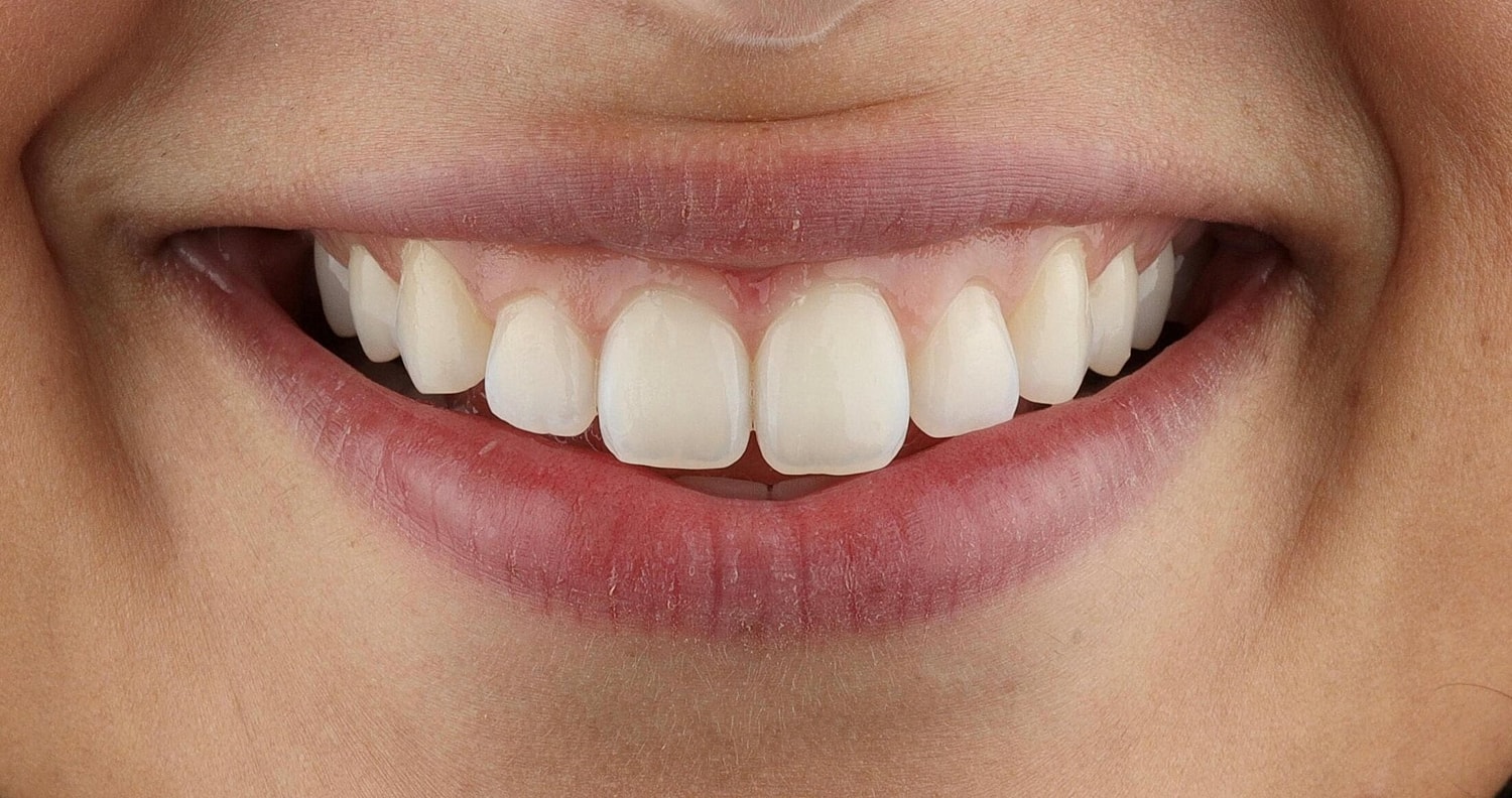 Patients Before & After