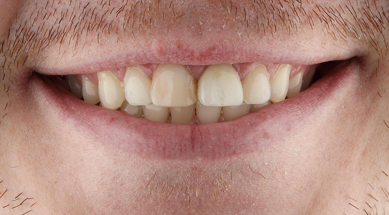 Patients Before & After
