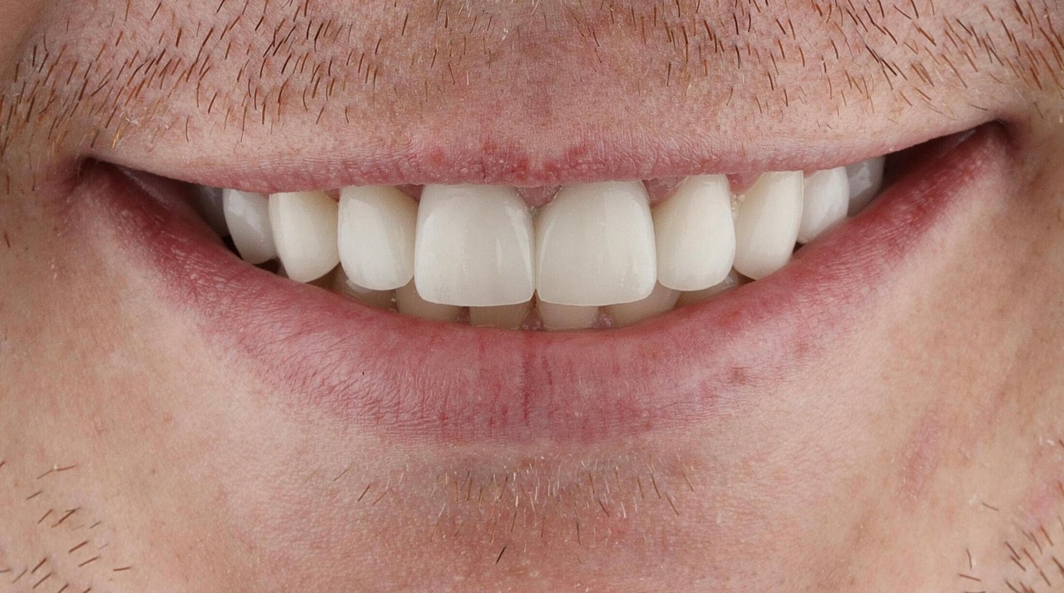 Patients Before & After