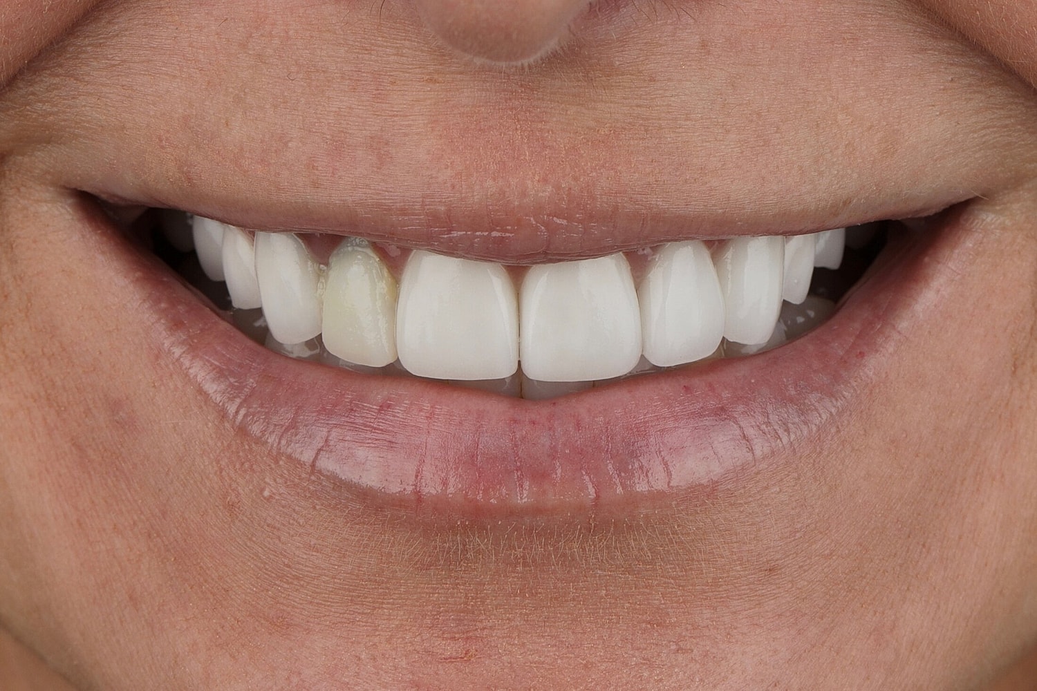 Patients Before & After