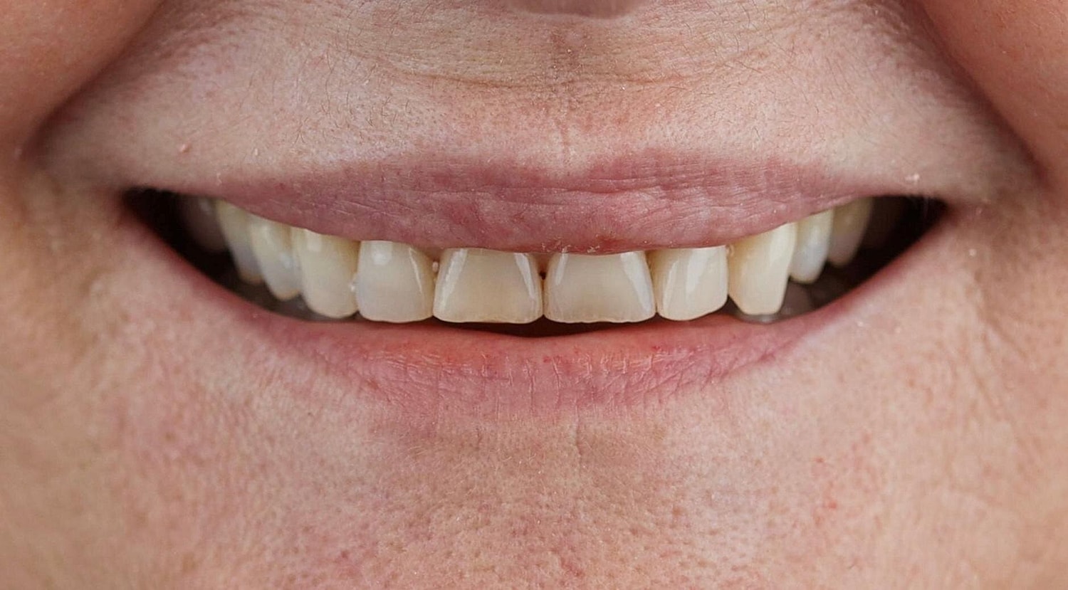 Patients Before & After