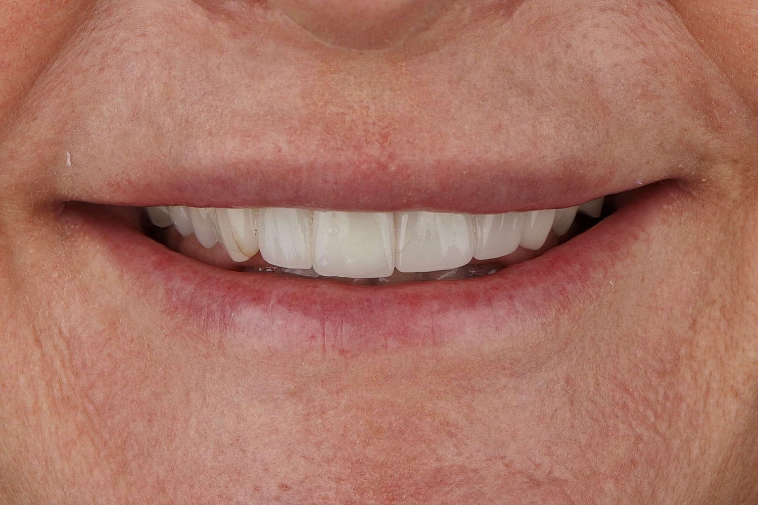 Close-up of a smiling mouth with white teeth.