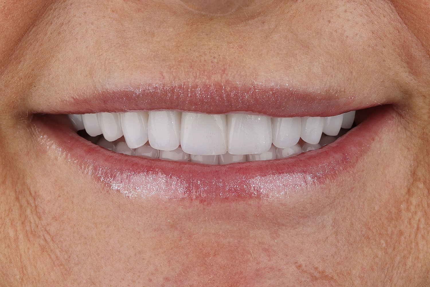Close-up of a healthy, smiling mouth.