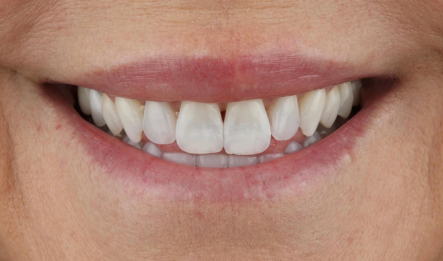 Patients Before & After