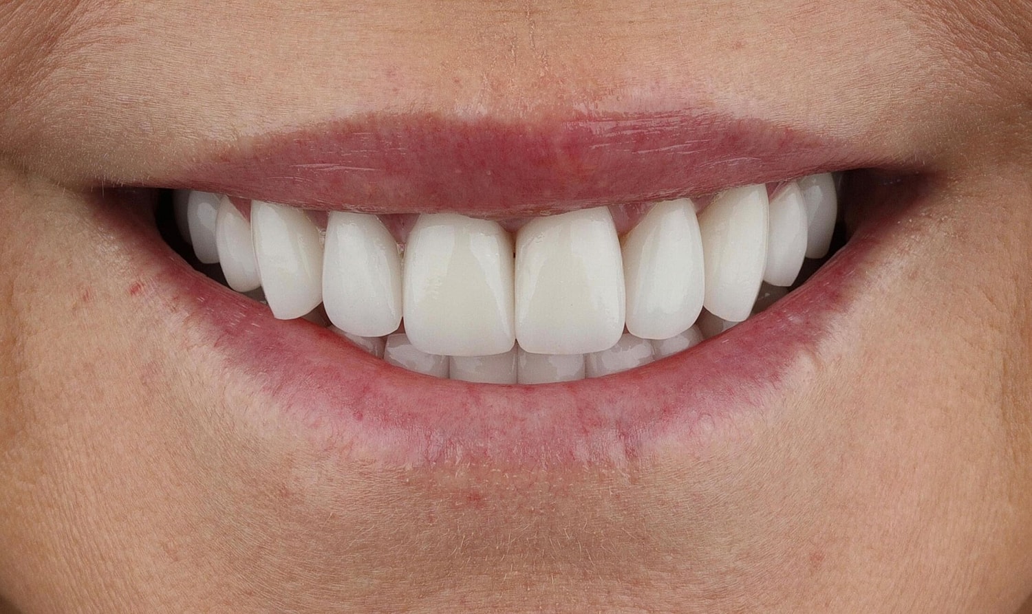 Patients Before & After
