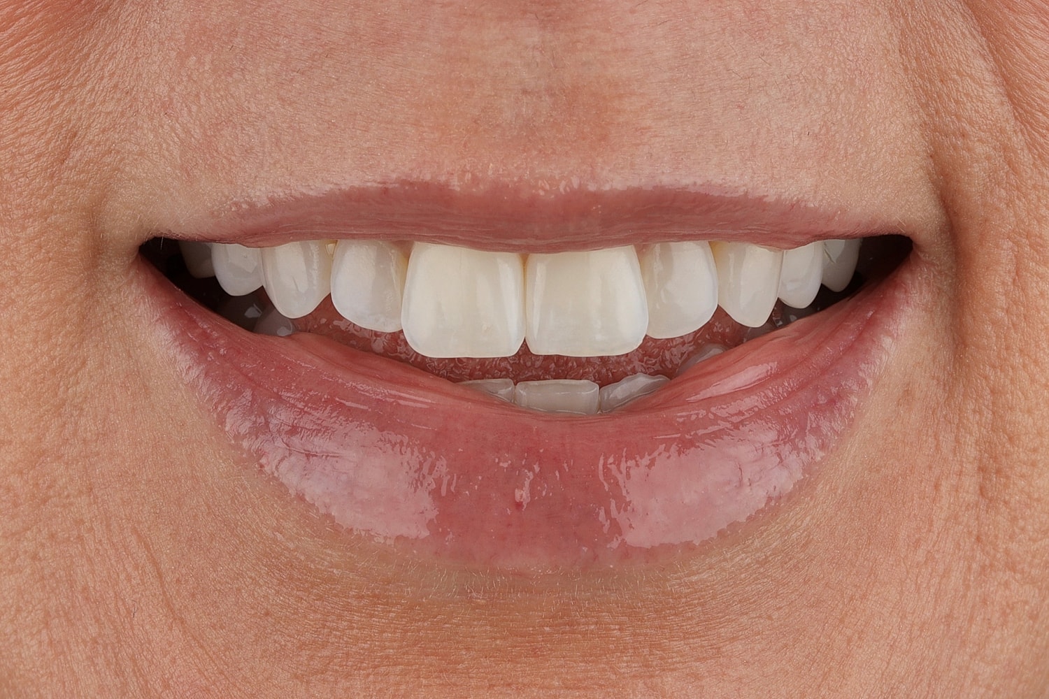 Smiling mouth with healthy, white teeth.