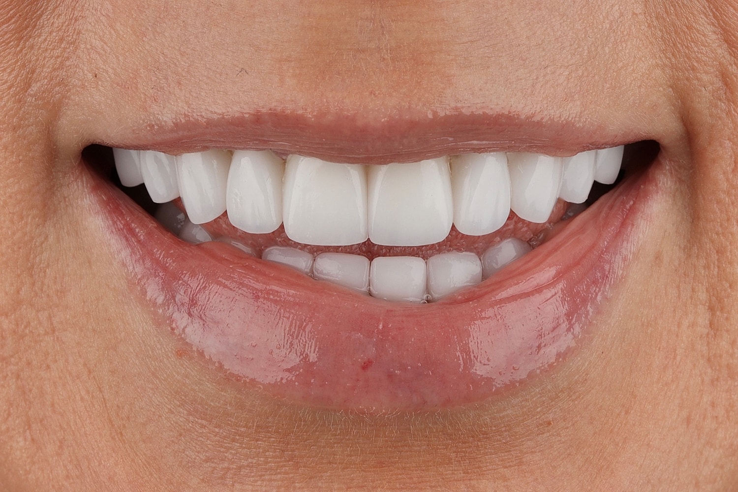 Smiling face with bright white teeth.