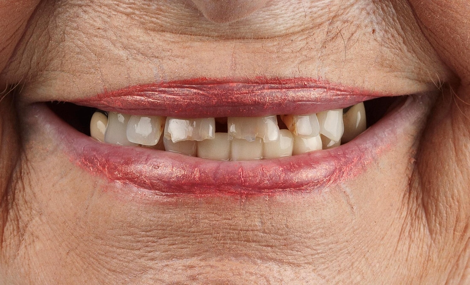 Patients Before & After