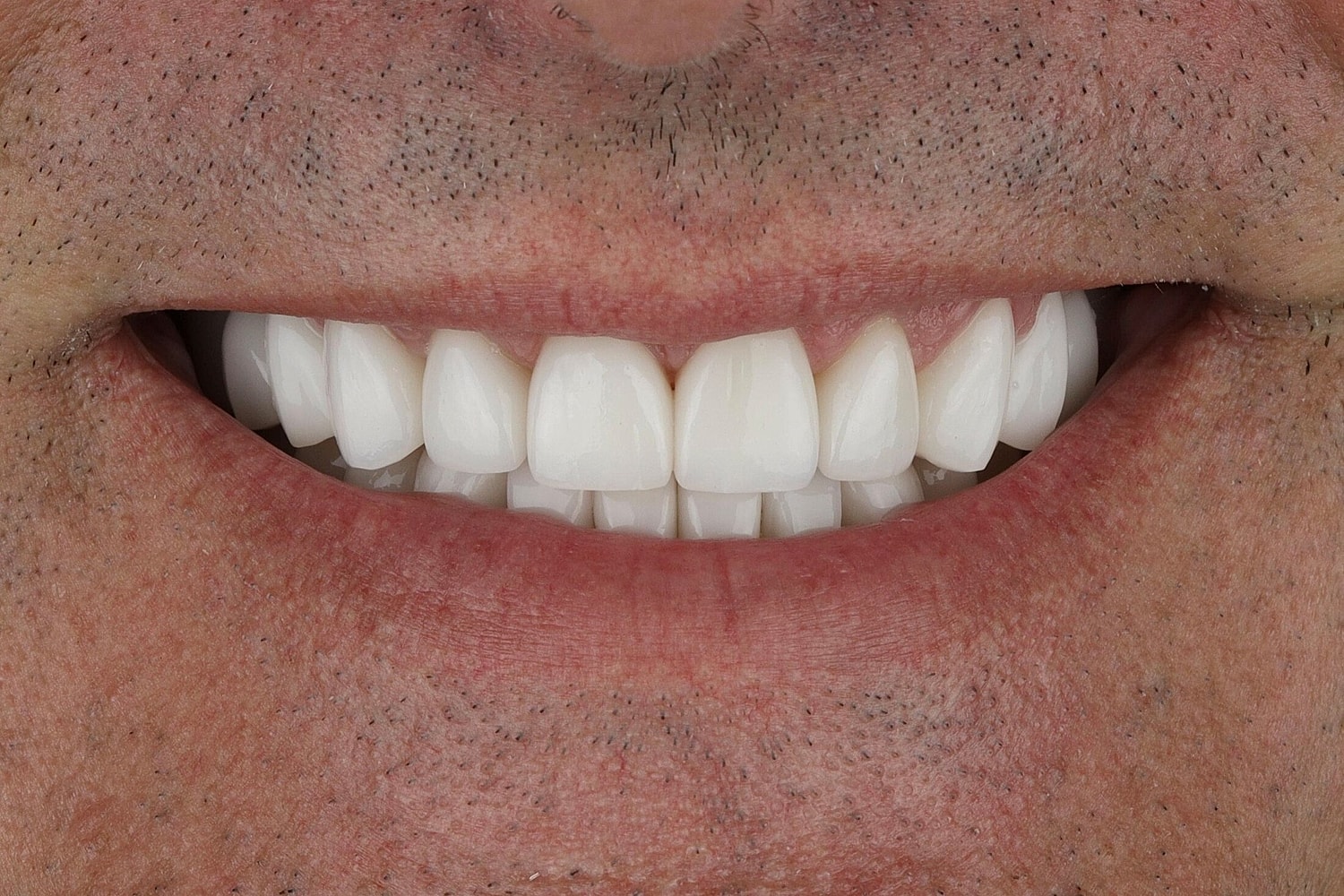 Patients Before & After