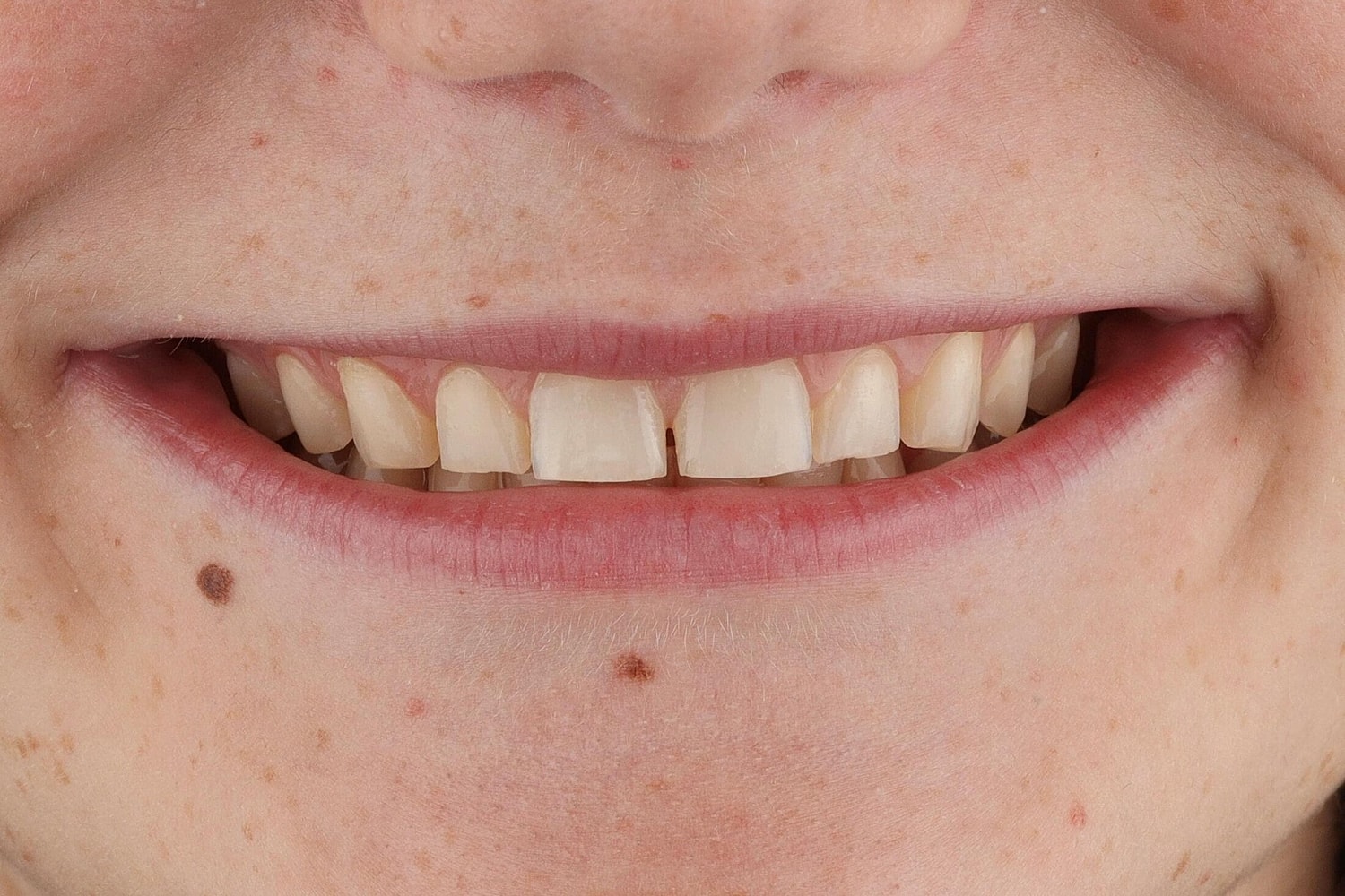 Patients Before & After