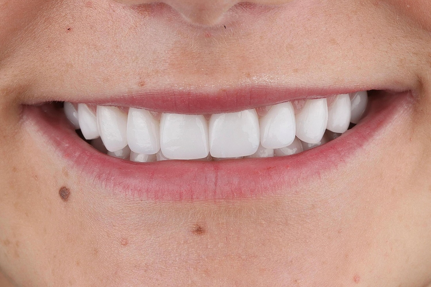 Patients Before & After