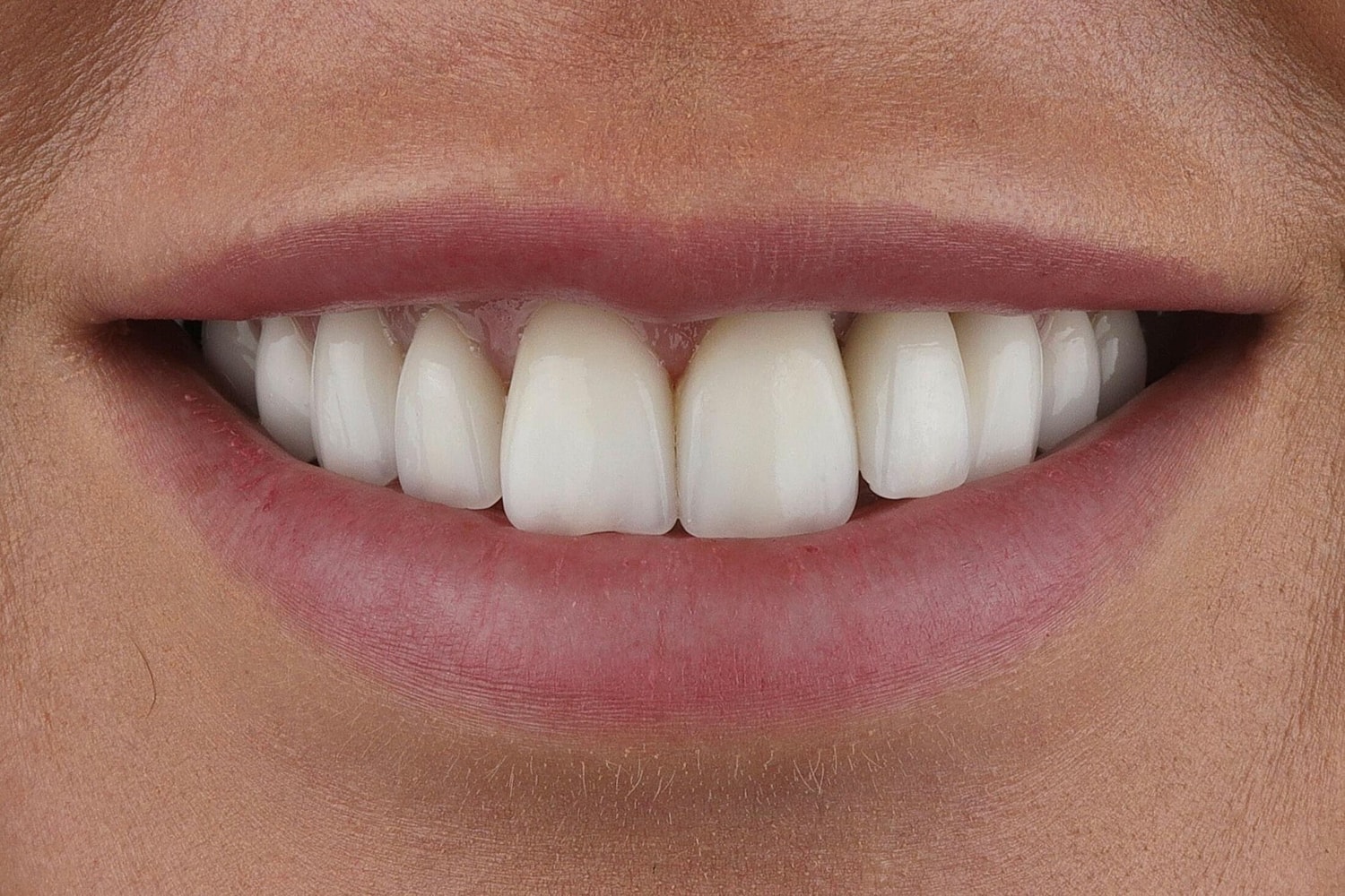 Patients Before & After